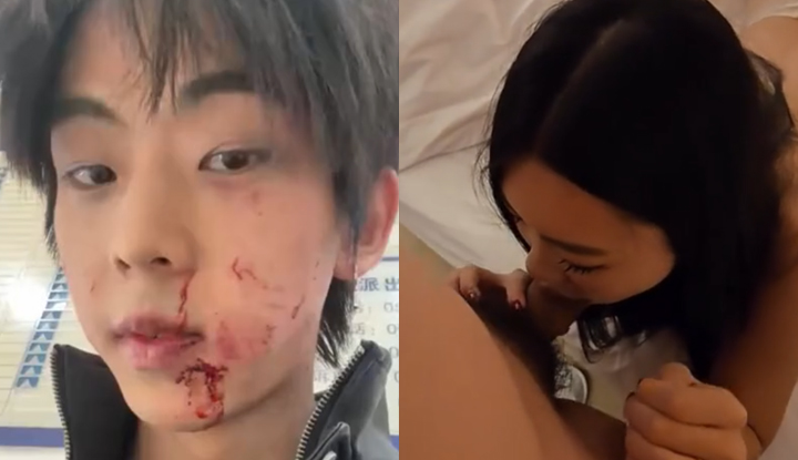 หญิงสาวร่ำรวยคนหนึ่งในเมืองฝูโจว มณฑลฟูเจี้ยน ถูกกล่าวหาว่าเลี้ยงดูนายแบบหนุ่มคนหนึ่งในฐานะพ่ออุปถัมภ์ แต่ถูกปฏิเสธเพราะเขามีกลิ่นตัว ด้วยความโกรธแค้น เธอจึงทำร้ายร่างกายเขาอย่างรุนแรงจนใบหน้าเสียโฉม จากนั้นทั้งสองก็ทะเลาะวิวาทกันในที่สาธารณะ จนมีการเปิดเผยบันทึกการสนทนาและวิดีโอเซ็กซ์จำนวนมาก!