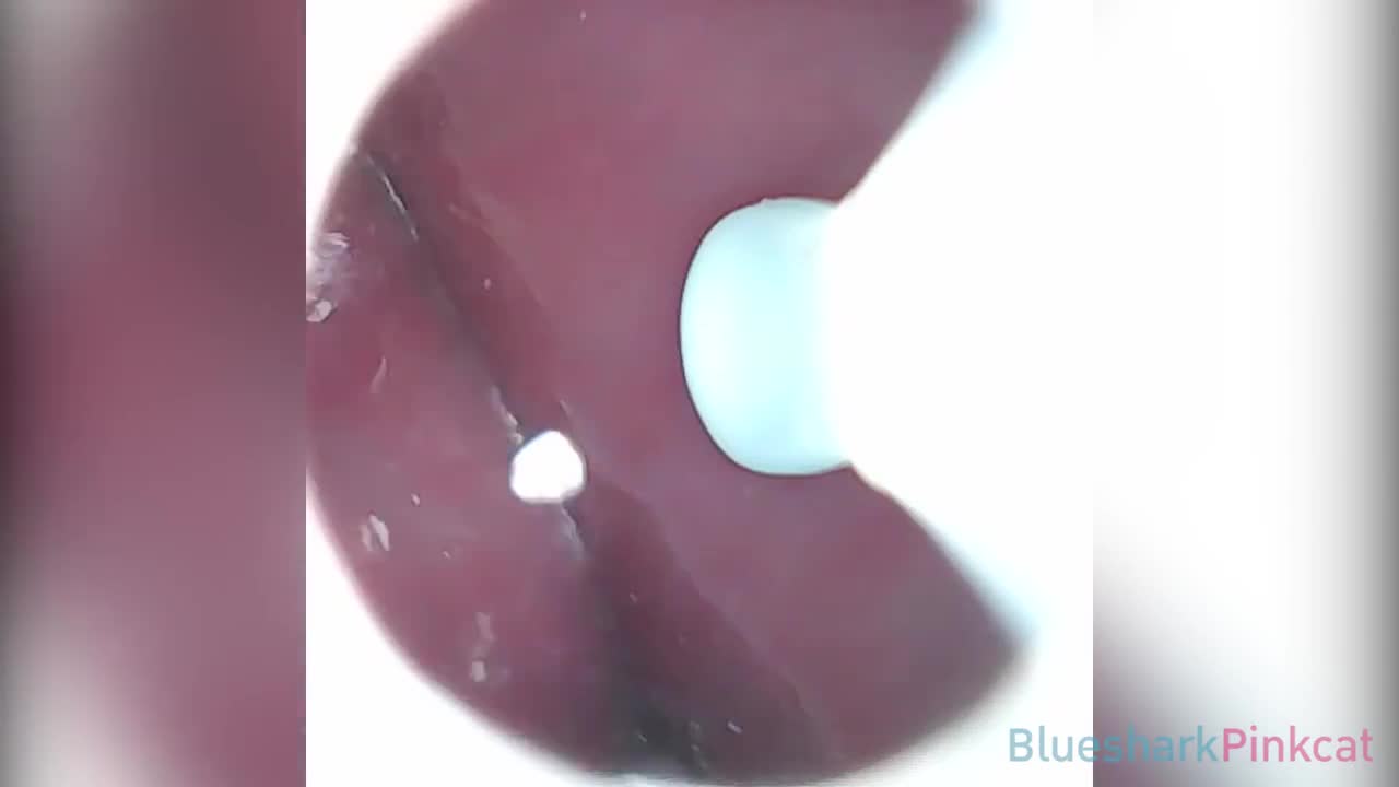 CAMERA INSIDE VAGINA AFTER INTERNAL CREAMPIE